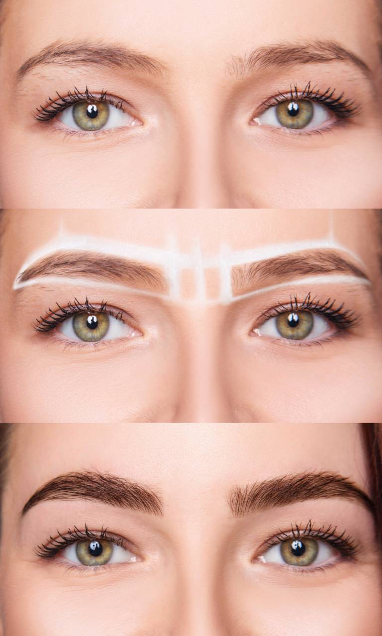 Restructuration sourcils